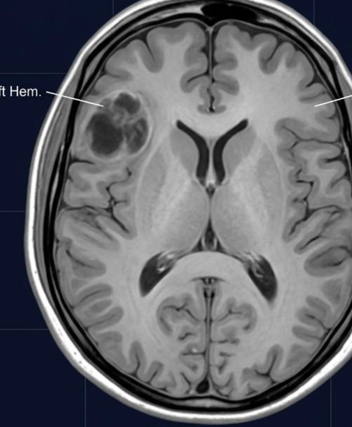 Illustrative axial MRI reference