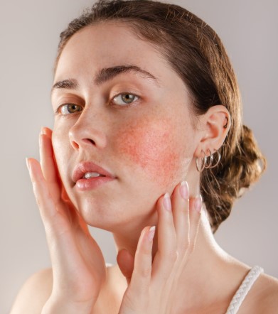 Sensitive Skin